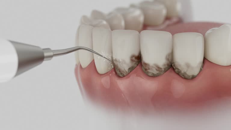 Reliable Root Canal Treatment contractor in Burleson County County, TX by Dentist Open Now